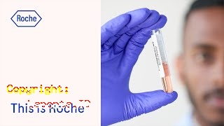 Roche Medical Company Terbaru Hari Ini Jumat 19 April 2024